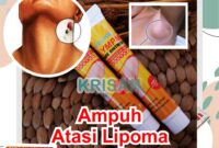 Krim Debu Meditasi dan Getah Gelisah: Penawar Utama Kegelisahan Anda